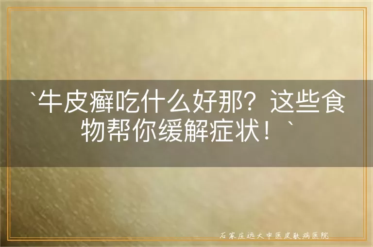 牛皮癣吃什么好那？这些食物帮你缓解症状！