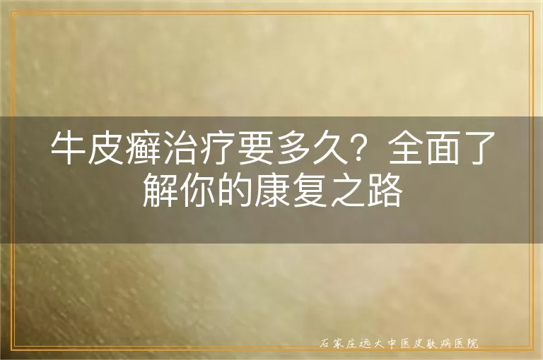 牛皮癣治疗要多久？全面了解你的康复之路