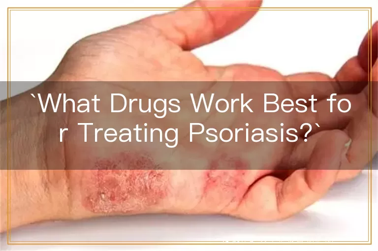 What Drugs Work Best for Treating Psoriasis?