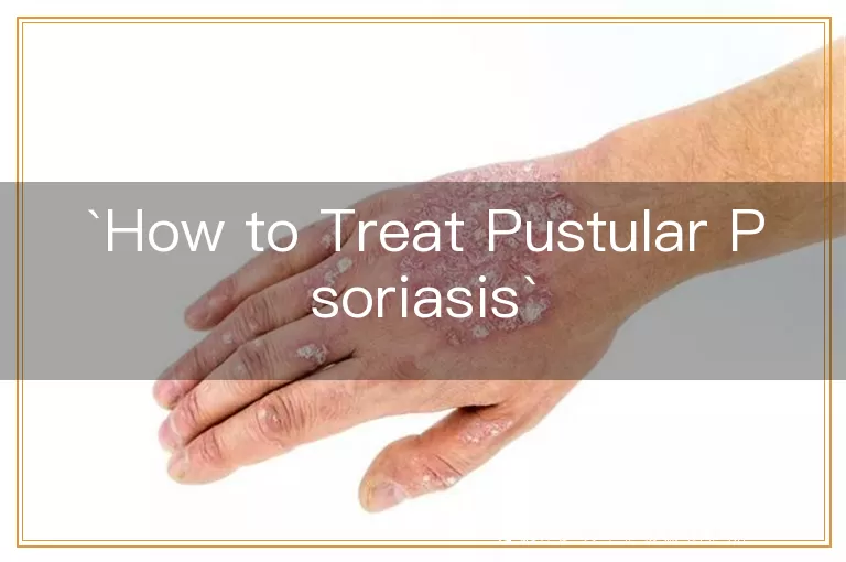 How to Treat Pustular Psoriasis